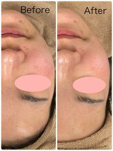 ロイ(Loy)/25/3/14ブログご覧ください♪