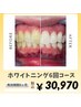 【まずはお試し♪】☆高濃度ジェル採用☆ホワイトニング6回コース¥30,970