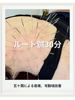 鍼日和/ルート鍼３０分 お試しにも