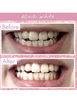 エクシアホワイト 長野店/