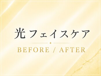 エルミューノ(elμno)/ここから光フェイスケア症例です
