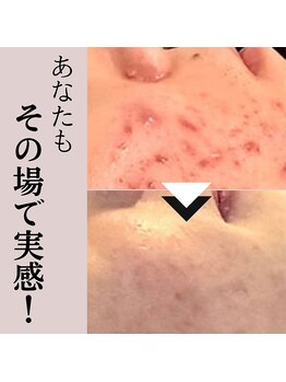 ベベ 大阪中央店(Be’be’)/その場で実感！ビフォーアフター