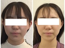 ウェリナ平和堂長久手院/小顔矯正/骨盤矯正/痩身/整体