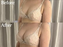 ジョリー(Jolie)/