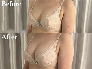 ジョリー(Jolie)/