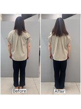 シャウルデッサン(CHARLESDESSIN)/フェムケア矯正