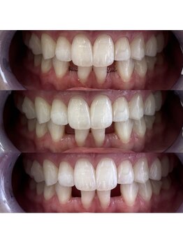 White base 【蘇我ホワイトニングサロン】/