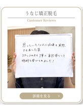 ミース 上野店/うなじ脱毛お客様の声