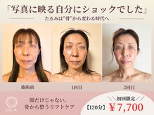 オラ(Ola)