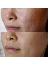 トラット エステアンドアイズ(tratto)/20代　お客様症例写真