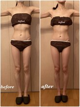 アンフィニ(infini)/ブライダルコース5回（2ヶ月)