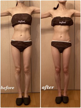 アンフィニ(infini)/ブライダルコース5回(2ヶ月)