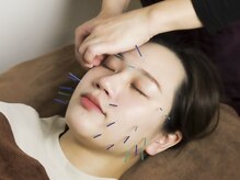 アリッシュ(ARiSH)/美顔鍼肩首セット