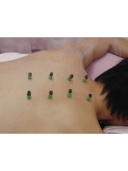 鍼灸施術を受けたい