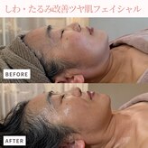 エステサロン マコ(MaCo)