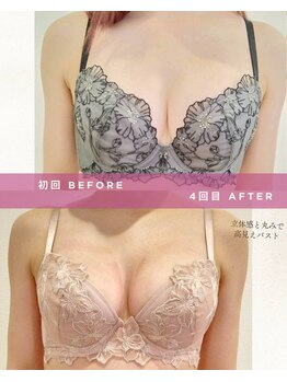 ククー(coucou)/4回施術でここまで変化