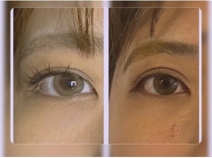ハルハル(Haru Haru)の写真