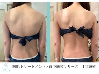 フローレ 平針店(Flore)/花嫁様に人気のボディハーブ