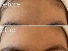 フォー(For...)/肌質改善はFor..にお任せ♪