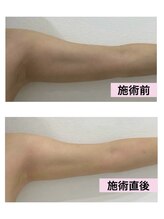 ムーンライズ(moonrise)/