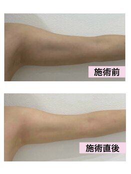 ムーンライズ(moonrise)/