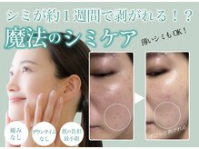 チャマ 徳島本店(CHAMA)の雰囲気（選べるケアで、一人ひとりの悩みを解決!!しみ、毛穴ケアはお任せ）