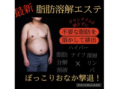 リリーローズ(LilyRose)の写真