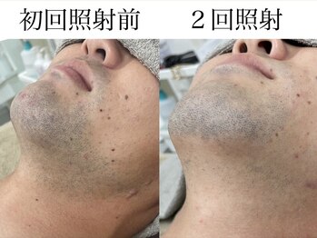 テンパ ビューティー(+10%beauty)/効果写真