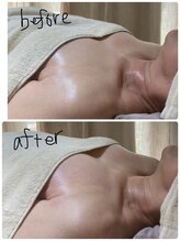 シトロン(citron)/バストケア