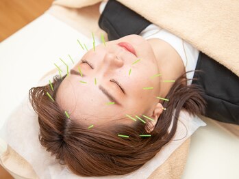 トトノウ(TOTONOU)/今話題の美容鍼