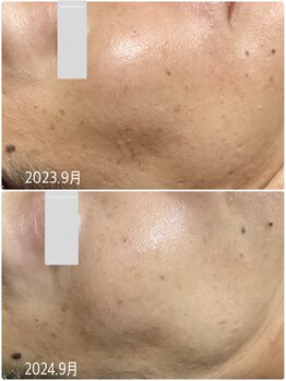 ブライトリー(Brightly)/徹底美肌に!