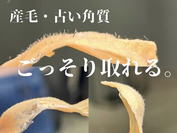 ワクシー 中目黒(WAXYYY.)/毛穴/肌質改善!フェイスワックス