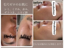 ペルボヌールの雰囲気（白を基調とした高級感ある店内★駅近だからメンテで通いやすい）