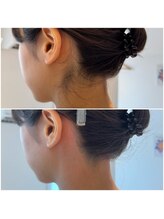 シュク(SHUKU)/うなじ & もみあげ 