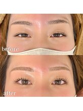 リレン 町田店(RIREN)/セットメニューでお悩み改善