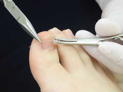 ドクターネイル爪革命 苫小牧店の写真