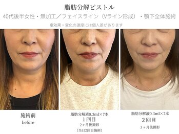 サボラミ(sabor A Mi)/お悩みの部分を改善します◎