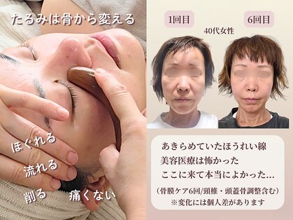 オラ(Ola)の写真