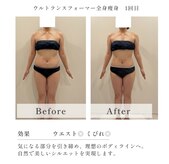 テトテ(TEtoTe)
