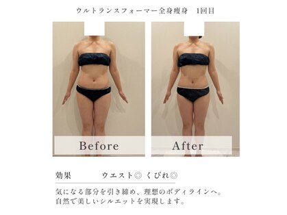 テトテ(TEtoTe)の写真