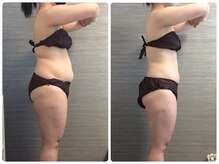 美容整体ウェリナ あま甚目寺院/小顔矯正/骨盤矯正/美脚サロン