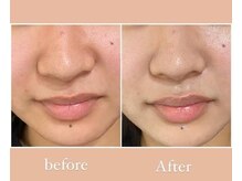 ツルリの雰囲気（結果重視のフェイシャルメニューも豊富です☆）