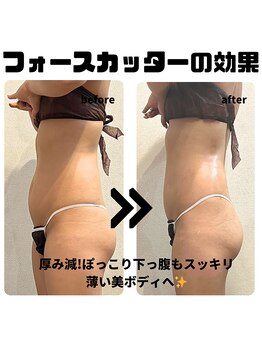 アンバー(amber)/ぽっこり下っ腹もスッキリ!