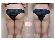 サロンドタエ(salon de TAE)/ボディコース選べます