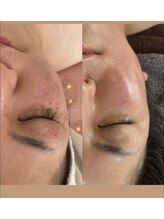 サロンドココリール(salon de cocorire)/Lit  12回