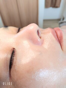 クラリス(Clarice)/きめ細かなお肌には…