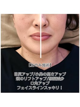 ココオーブ(COCO AUBE)/本格ドライヘッドスパで小顔に