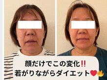 ヨサパーク エー(YOSA PARK A)