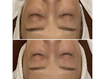 トータルエステティック ジョワイユ(JOYEUX)/再生美容プログラム☆