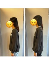 カイ 井荻駅前(KAI)/肩こりでご来店初回施術後変化例